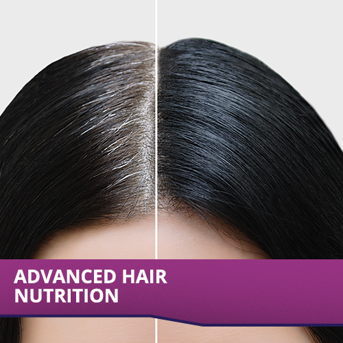Wellwoman Hairfollic supplements with Advanced Hair Nutrition formula for Women with Biomarine collagen complex,Biotin &Zinc that support hair growth & maintain healthy hair|30 Nonveg tablet,200 grams