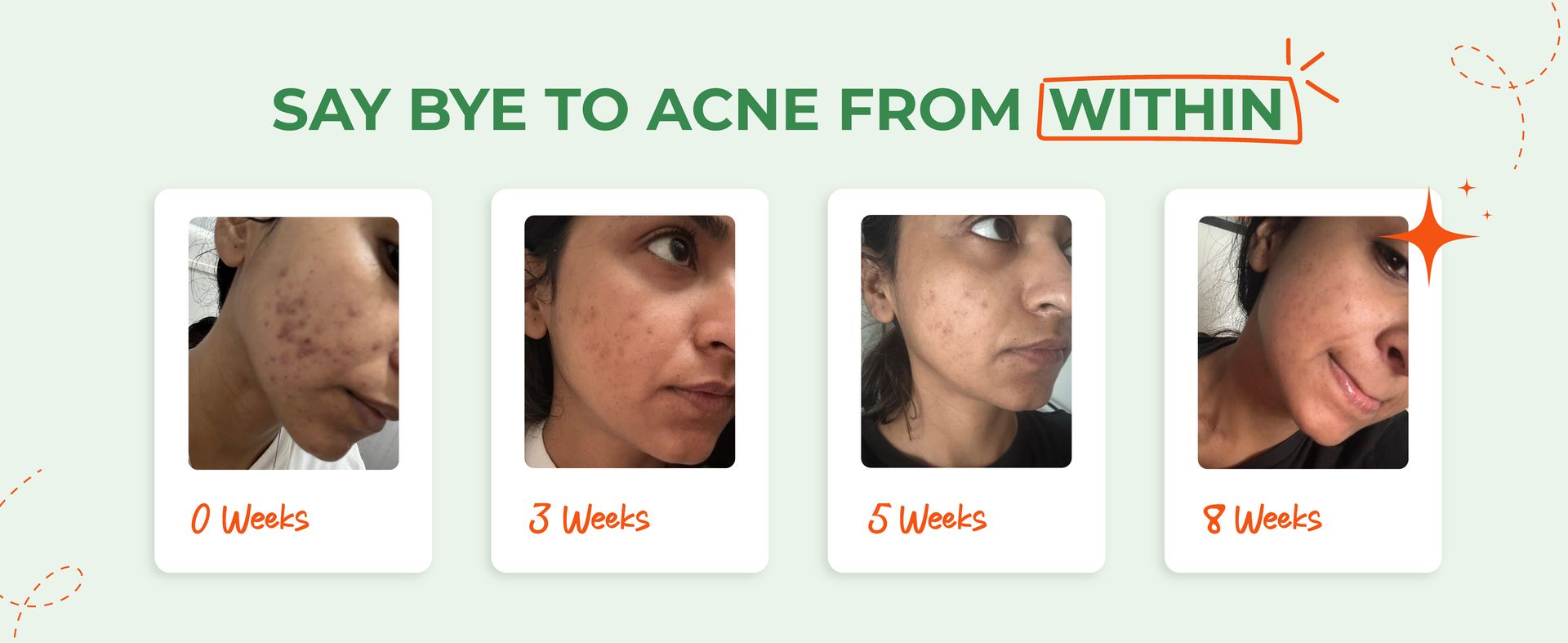 Beyond Clear Skin Acne Supplement for Women & Men | Detox for Clear Skin | Natural & Herbal ingredents, No Chemicals & Colors | Healthy Skin, Hair & Nails 60 Veg Tab