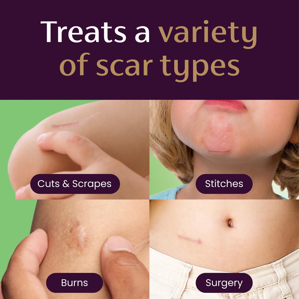 mederma-scar-gel-for-kids-reduces-appear-6.jpg