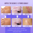 silicone-scar-cream-scar-gel-advanced-sc-6.jpg