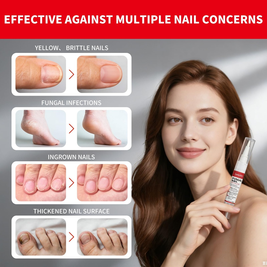 toenail-fungus-pen-treatment-extra-stren-6.jpg