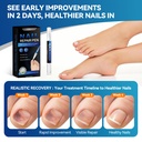 nail-fungus-treatment-pen-5-count-25-und-5.jpg