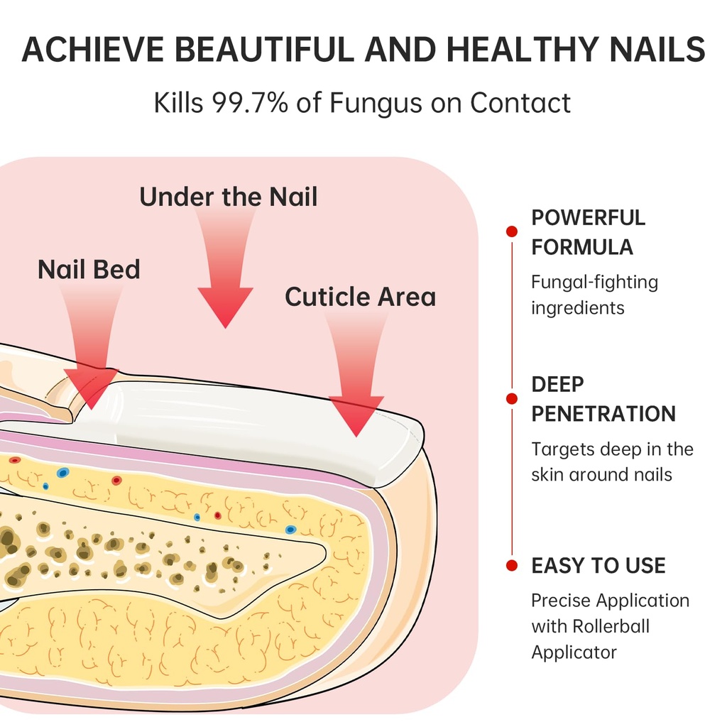 nail-fungus-treatment-extra-strength-1-t-3.jpg
