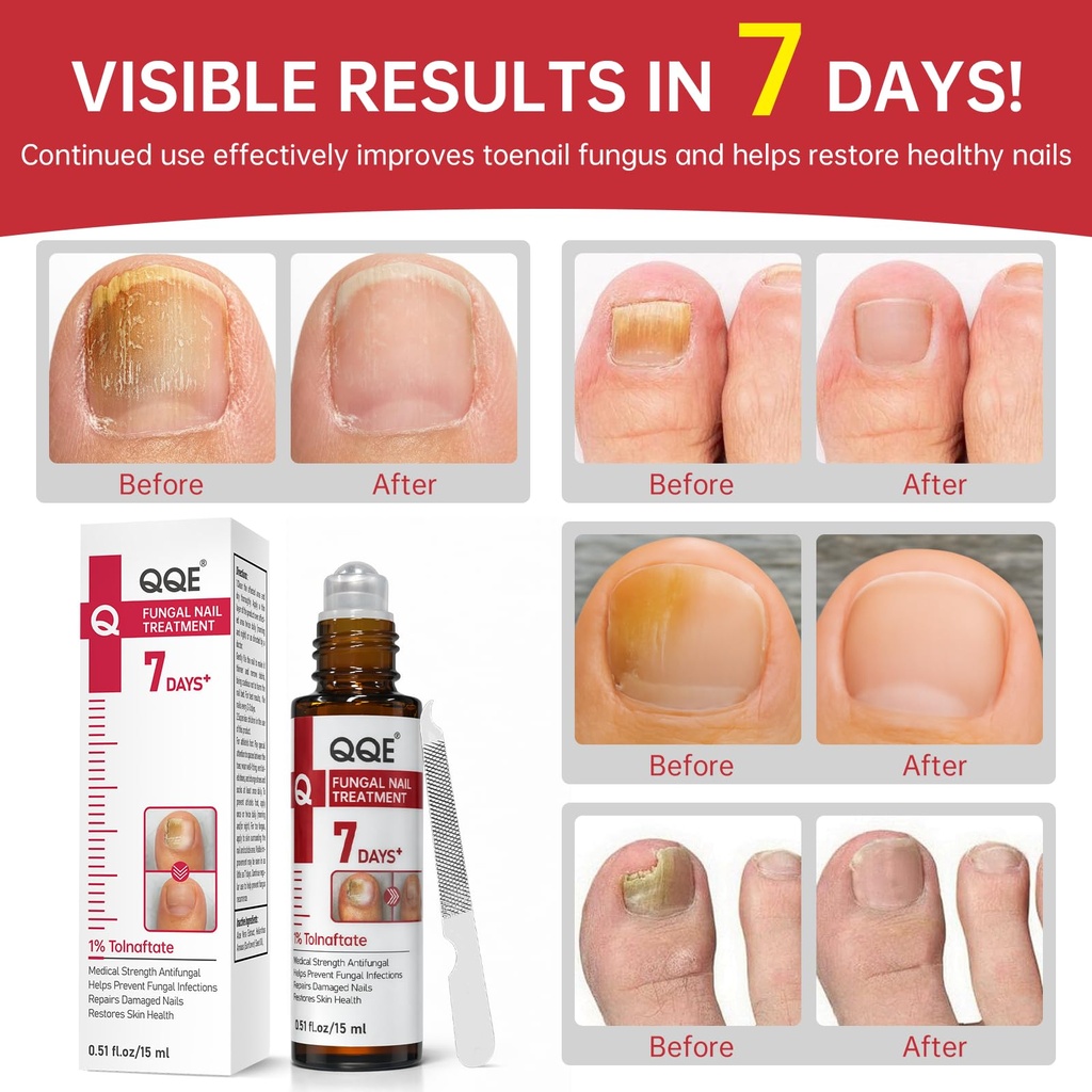 nail-fungus-treatment-extra-strength-1-t-4.jpg