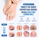 nail-fungus-treatment-25-undecylenic-aci-2.jpg