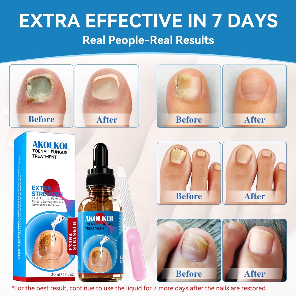 toenail-fungus-treatment-extra-strength--3.jpg