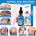 toenail-fungus-treatment-extra-strength--5.jpg