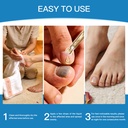 toenail-fungus-treatment-extra-strength--6.jpg