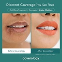 coverology-cold-sore-treatment-cold-sore-3.jpg