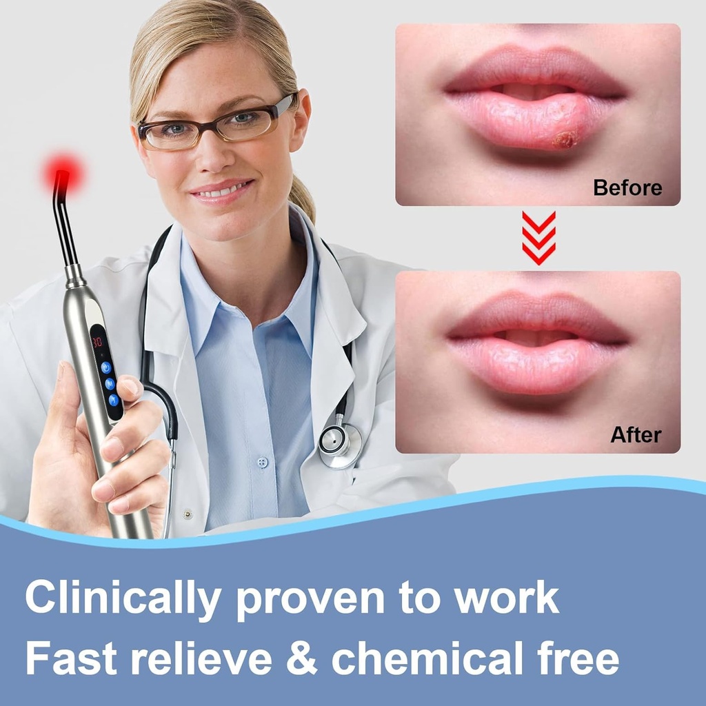 red-light-cold-sore-device-cold-sore-tre-2.jpg