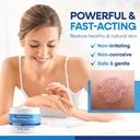 hermon-tinea-versicolor-treatment-cream--4.jpg