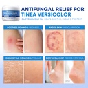 hermon-tinea-versicolor-treatment-cream--6.jpg