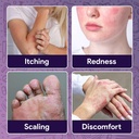 fifthpulse-miconazole-antifungal-cream-4-4.jpg