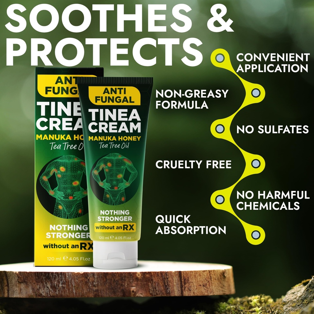 tinea-versicolor-treatment-antifungal-cr-3.jpg