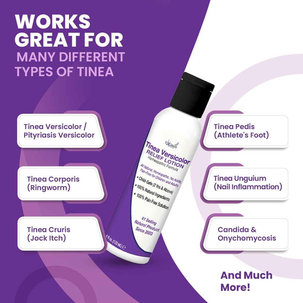 naturasil-tinea-versicolor-treatment-lot-5.jpg