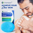 charmpoo-antifungal-soap-bar-for-itchy-s-81uPxgdF2qL.jpg