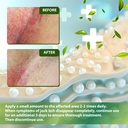recuren-plus-jock-itch-antifungal-skin-c-71v36GmK+LL.jpg