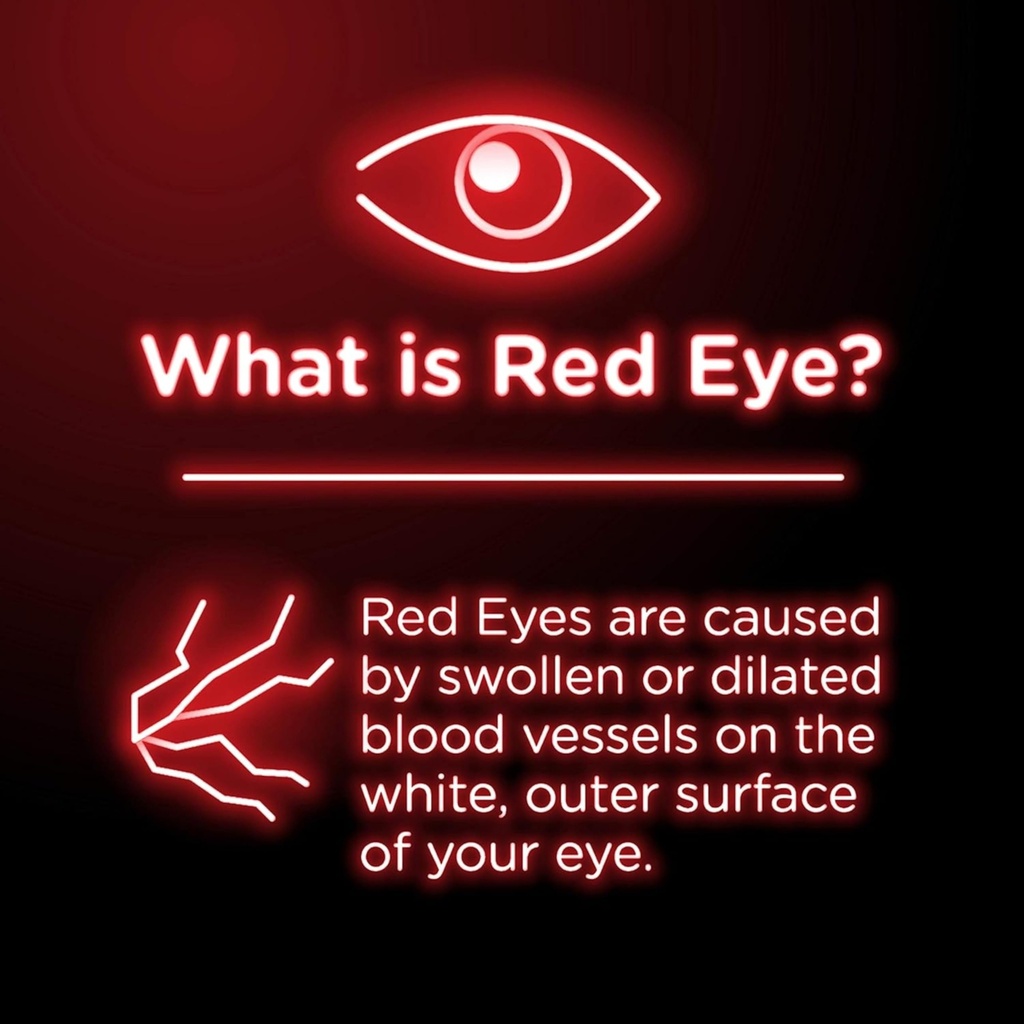 visine-original-redness-reliever-eye-dro-71s+ASz8XeL.jpg