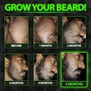 beard-growth-kit-wgrow-xxl-beard-oilseru-3.jpg
