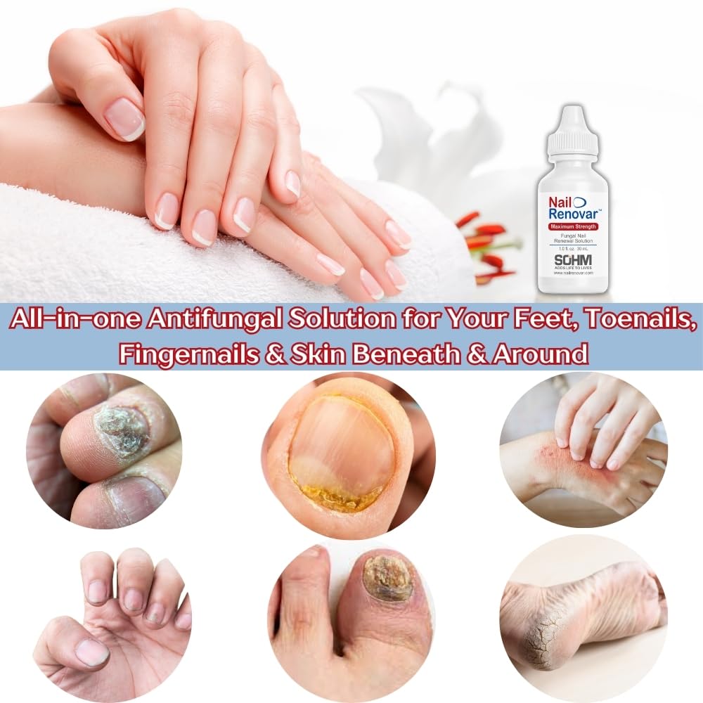toenail-fungus-treatment-extra-strength--4.jpg