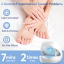 nail-fungus-laser-treatment-led-light-de-2.jpg