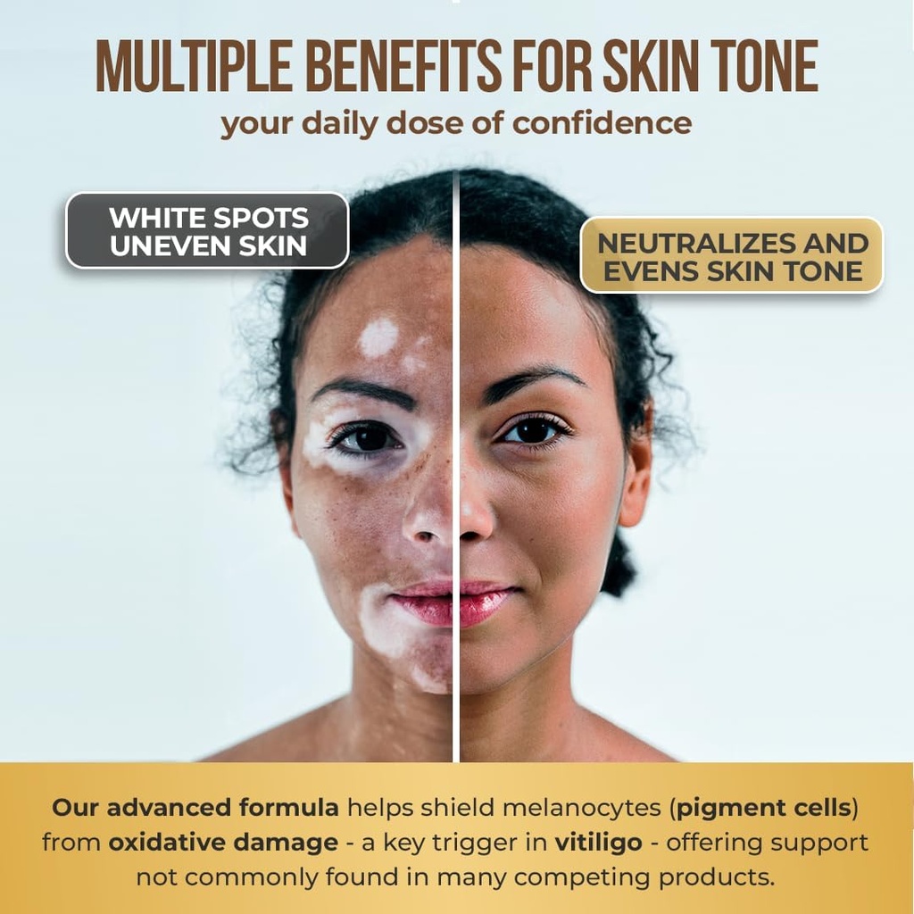 dermawonder-vitiligo-capsules-60-count-e-6.jpg