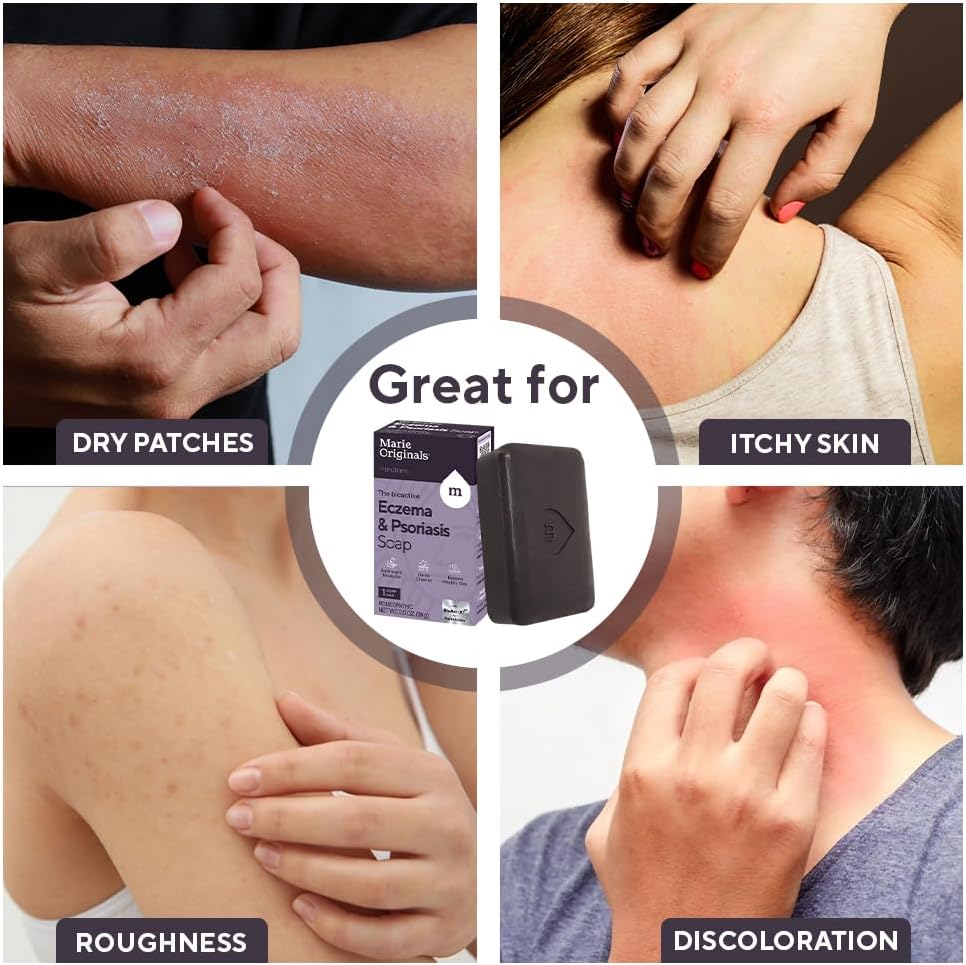 marie-originals-eczema-face-soap-body-wa-4.jpg