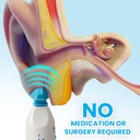 eardoc---ear-pressure-relief-device-ear--2.jpg