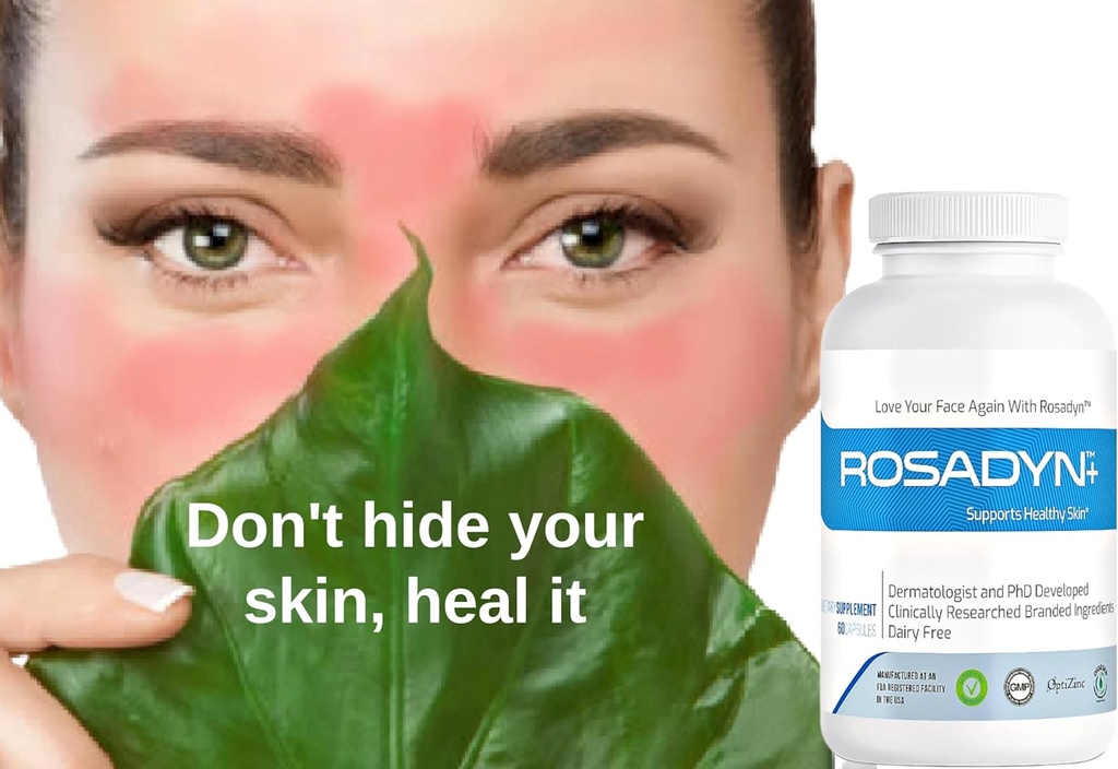 rosacea-skin-care-supplement-for-redness-6.jpg