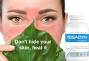 rosacea-skin-care-supplement-for-redness-6.jpg