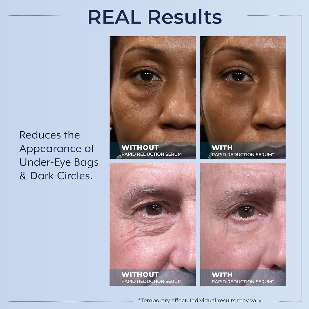 plexaderm-rapid-reduction-eye-serum---vi-6.jpg
