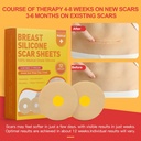 silicone-scar-sheets-for-breast-12-pack--5.jpg