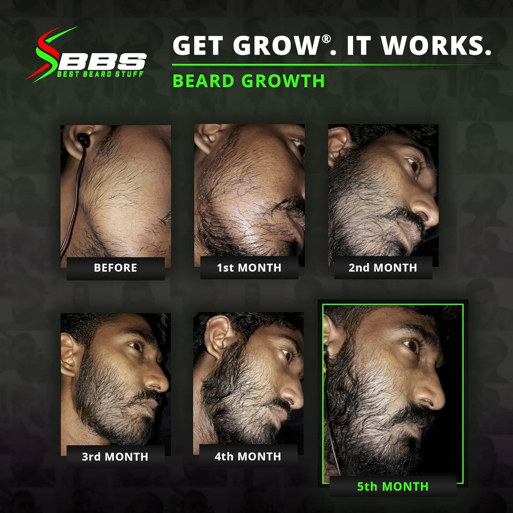 beard-growth-kit-wgrow-xxl-beard-oilseru-3.jpg