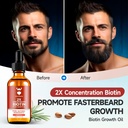 sandalwood-beard-growth-kit-with-2x-biot-6.jpg