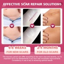 silicone-scar-sheetssilicone-scar-tape-f-3.jpg