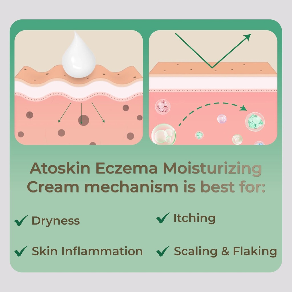 atoskin-eczema-cream-psoriasis-folliculi-6.jpg