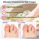 toe-nail-fungus-treatments-for-toenail-n-2.jpg