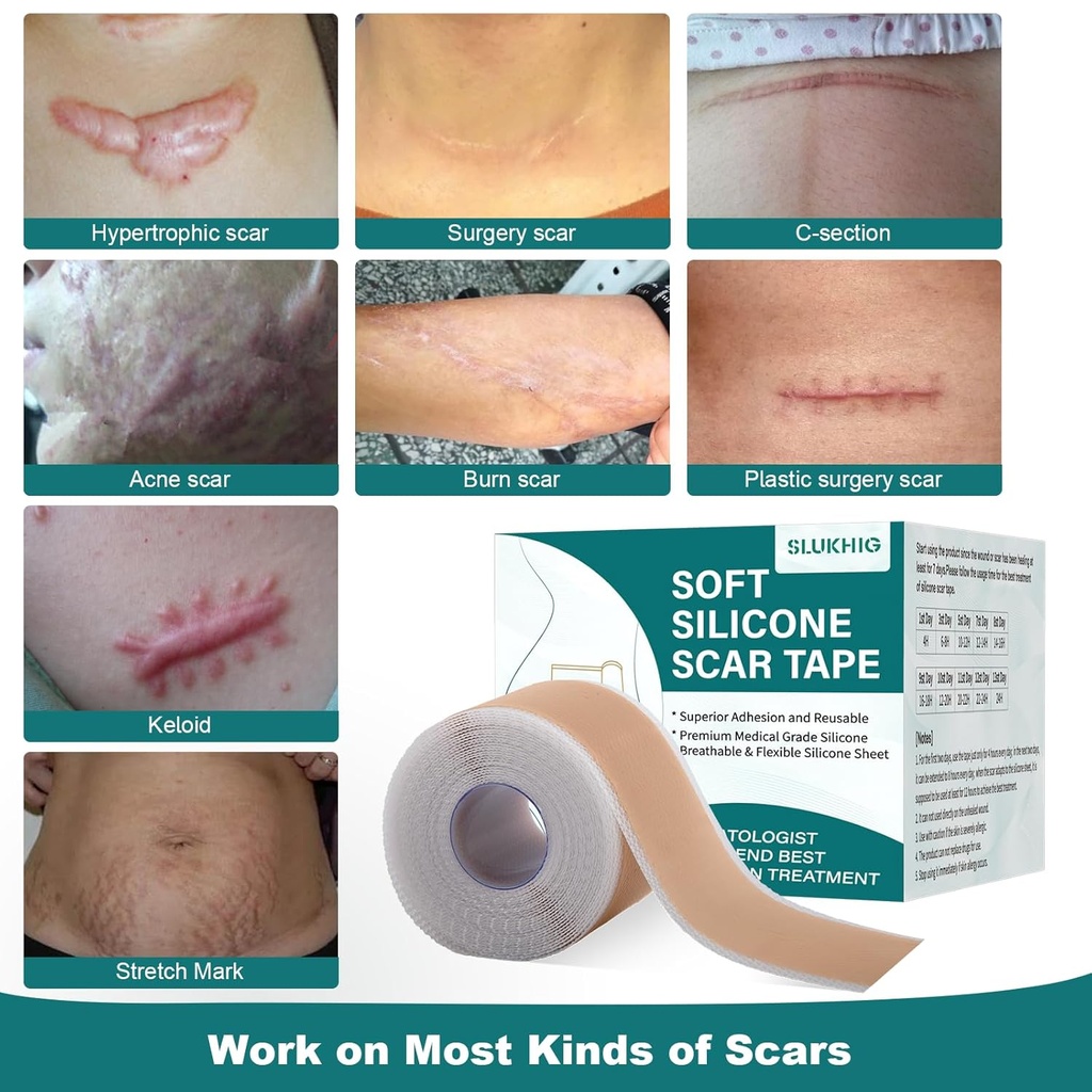 silicone-scar-sheets-16x-79-roll-2m-sili-2.jpg