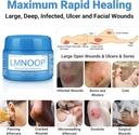 lmnoop-wound-healing-ointment-for-chroni-2.jpg