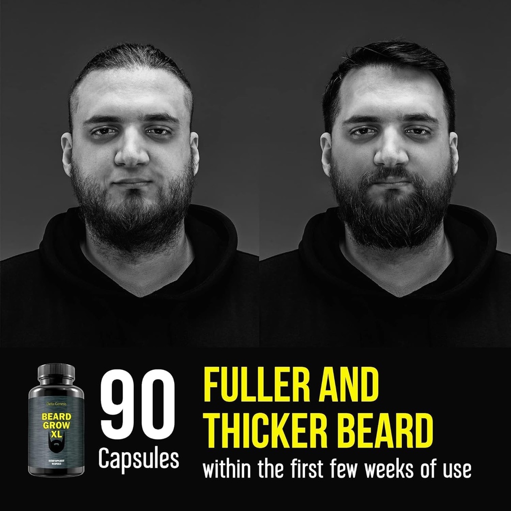 beard-flux-beard-grow-xl-and-beard-bolt--5.jpg