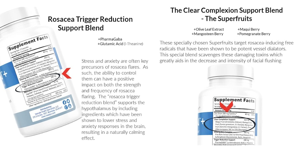 rosadyn-rosacea-skin-care-products-set-o-2.jpg