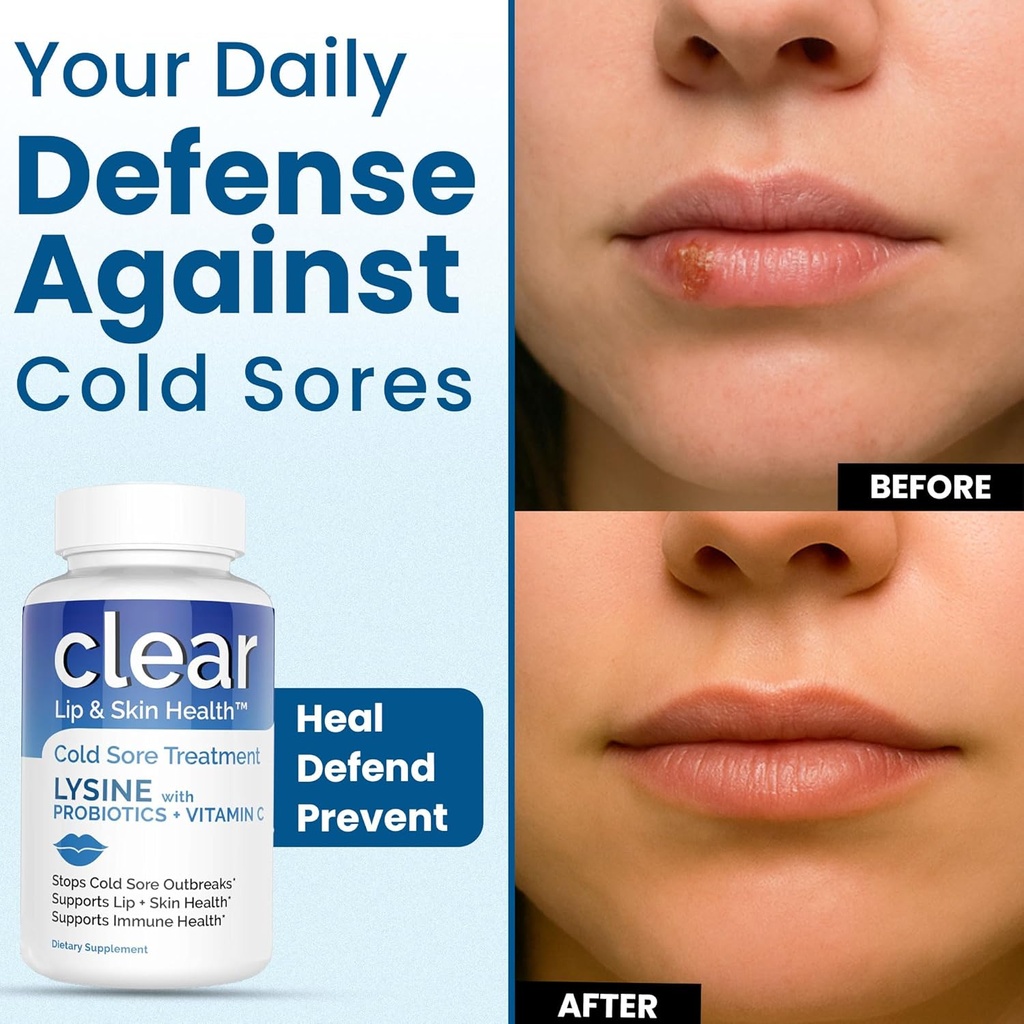 lysine-cold-sore-treatment-for-lips-with-5.jpg