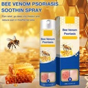 2-pcs-psoriaheal-bee-venom-psoriasis-tre-6.jpg