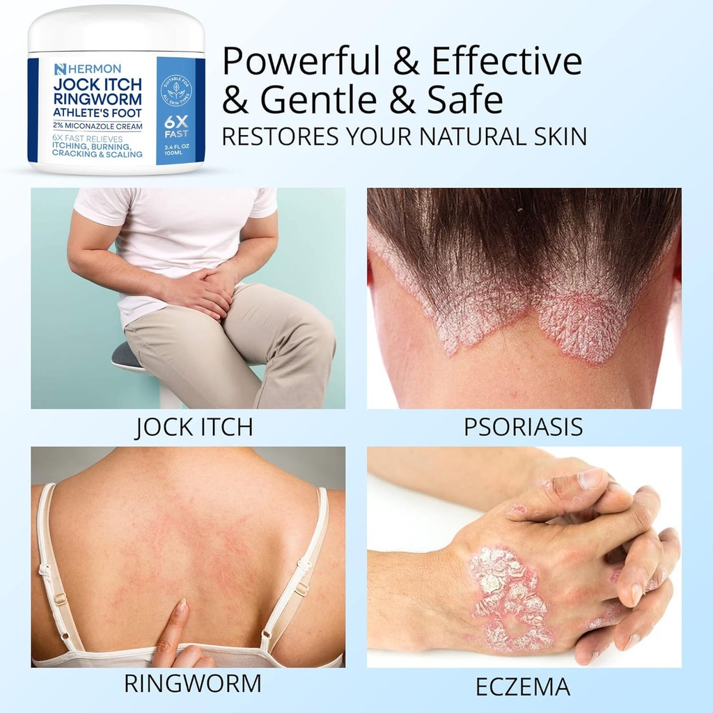 jock-itch-antifungal-cream-ringworm-trea-3.jpg