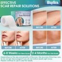 boysea-silicone-scar-sheets-16-x-120-cle-5.jpg