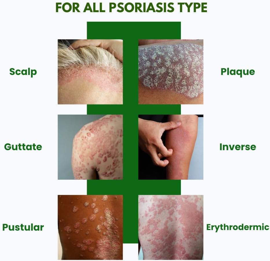 psodex-psoriasis-cream-34fl-oz-topical-p-5.jpg