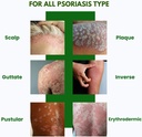 psodex-psoriasis-cream-34fl-oz-topical-p-5.jpg