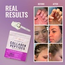 Live Conscious Collagen Peptides Powder Unflavored Packets-Hydrolyzed Collagen Powder-Hair, Skin, Nail, & Joint Support-Type I & III Grass-Fed Collagen Supplements for Women and Men - Pack of 20 (2Pk) 3