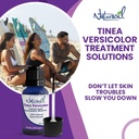 naturasil-powerful-tinea-versicolor-trea-2.jpg