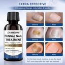 toenail-fungus-treatment-extra-strength--4.jpg